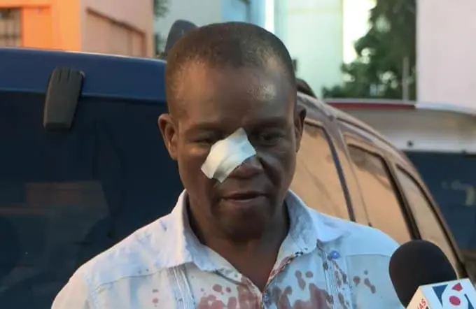 El profesor Naony Anderson Solano recibi&oacute; suturas en el rostro tras ser atacado con butacas y piedras. | FOTO: FUENTE EXTERNA