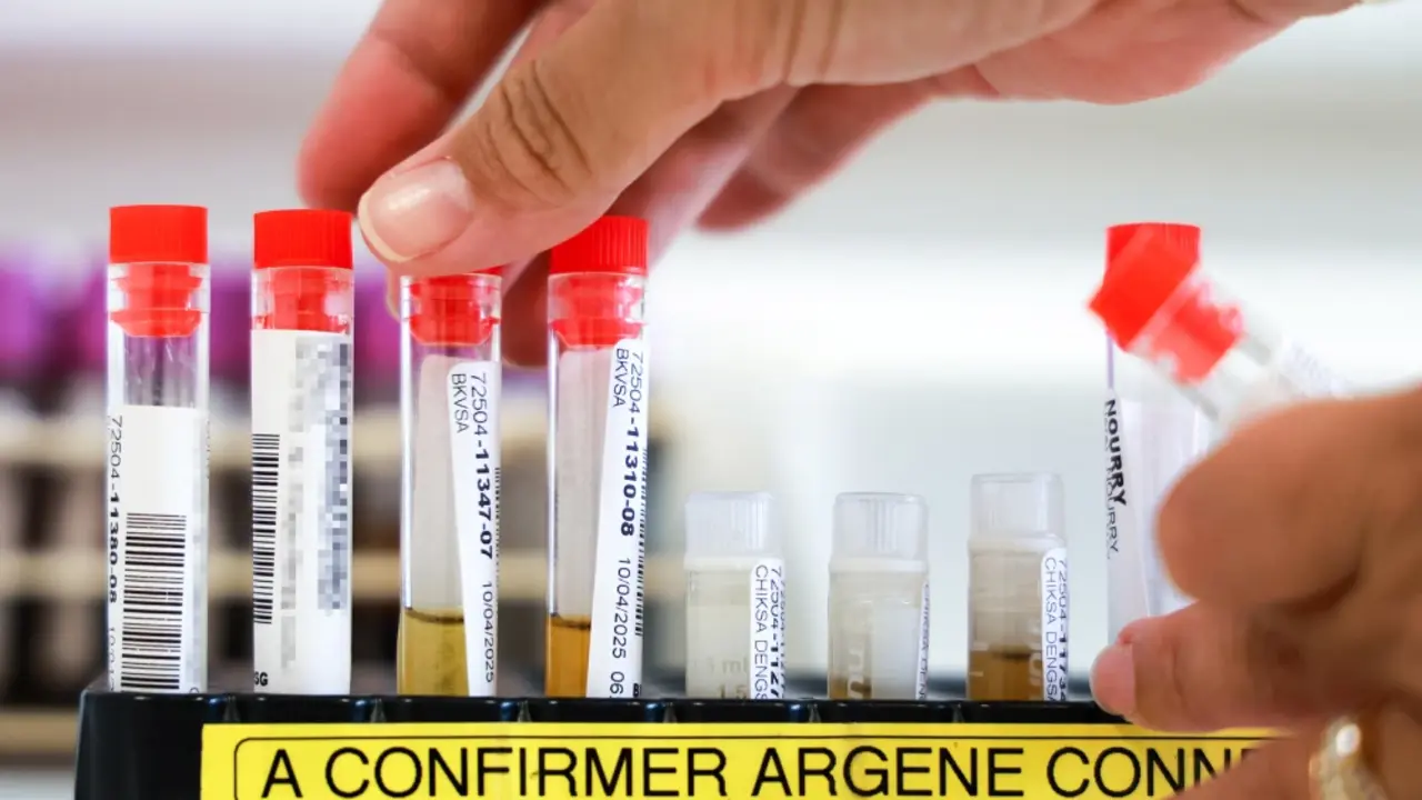 Confirman primer caso local de chikungu&ntilde;a en Nueva York | FOTO EXTERNA