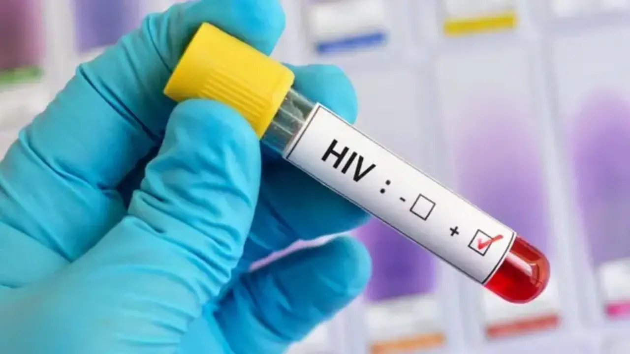 La OPS explic&oacute; que el VIH es una epidemia persistente desde hace 40 a&ntilde;os, no una alerta nueva. | FOTO REFERENCIAL / EXTERNA