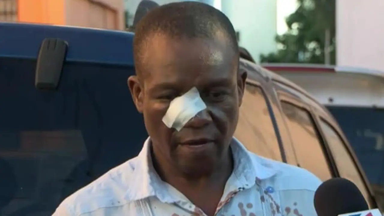 El profesor Naony Anderson Solano recibi&oacute; suturas en el rostro tras ser atacado con butacas y piedras. | FOTO: FUENTE EXTERNA